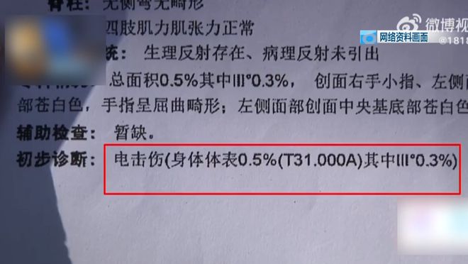5岁儿童爬空调外机瞬间晕厥！凯发国际平台肌腱都打断了！(图7)